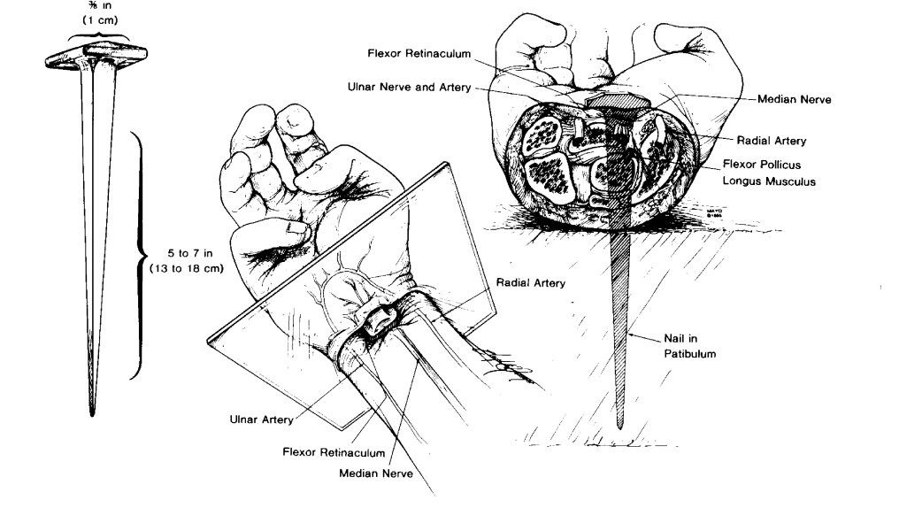 Nailing of the hand (Click to Enlarge)